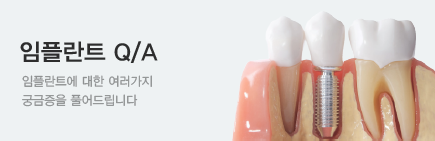 ���ö�Ʈ Q&A