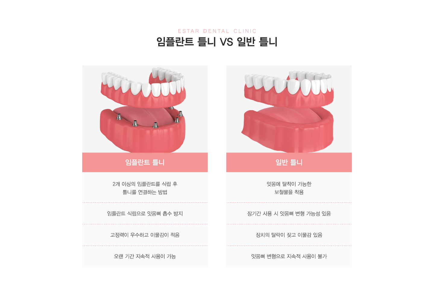 ���ö�Ʈ Ʋ�� vs �Ϲ� Ʋ��