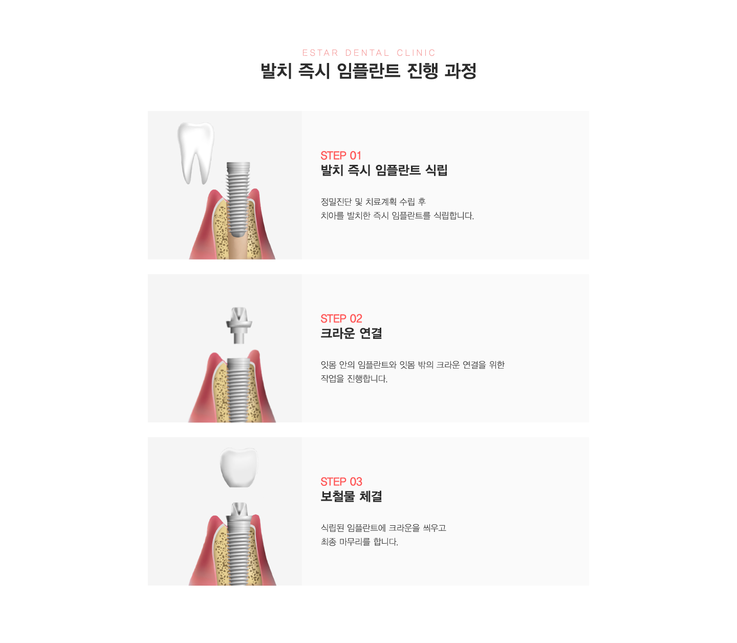 ��ġ������ö�Ʈ ���� ����