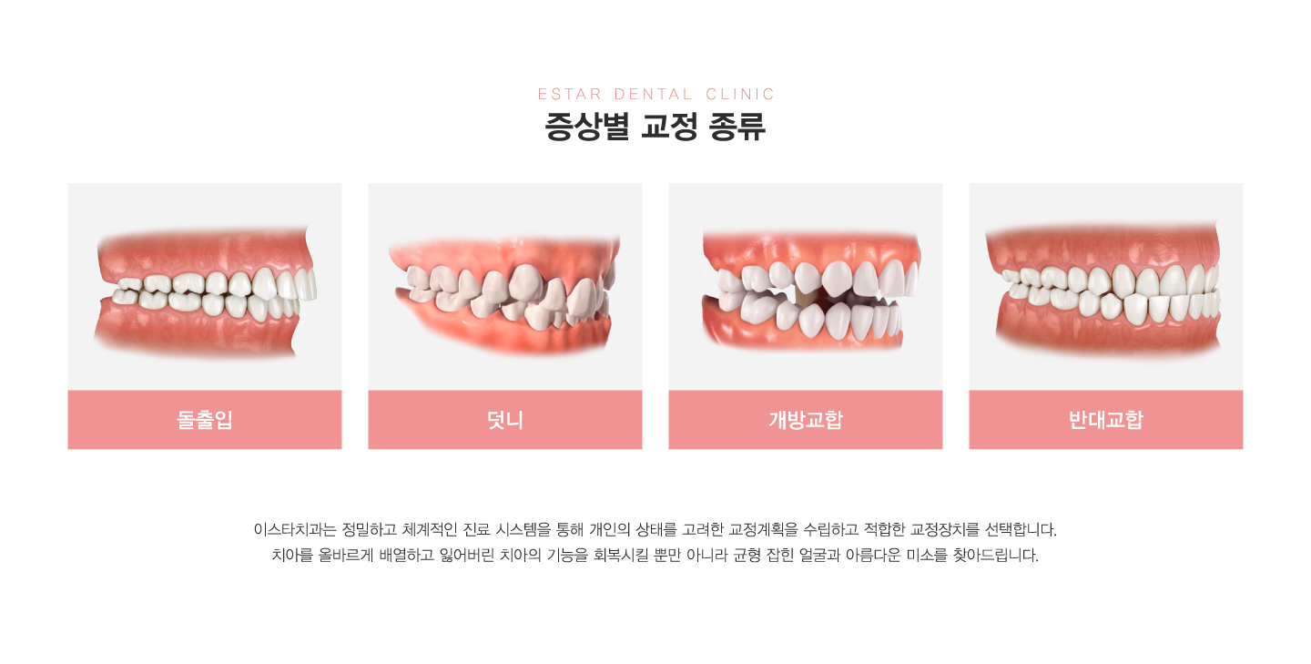 ���� ���� ���� ������ ���� ���汳�� �ݴ뱳��