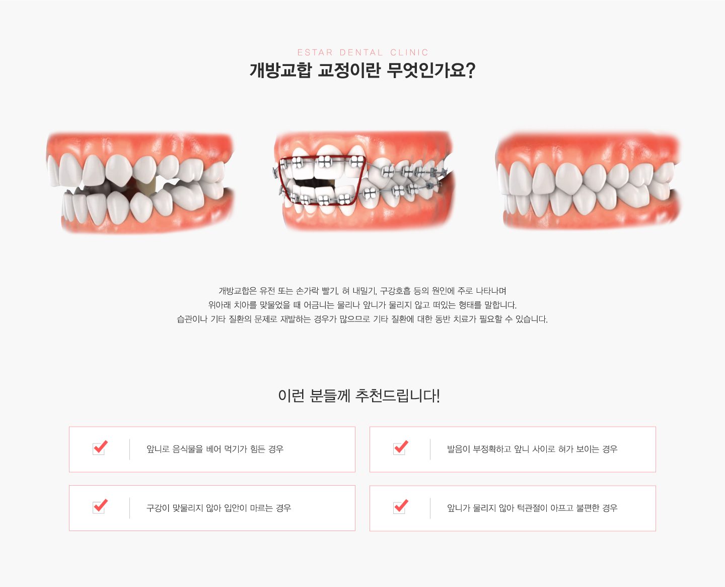 ���汳�ձ���