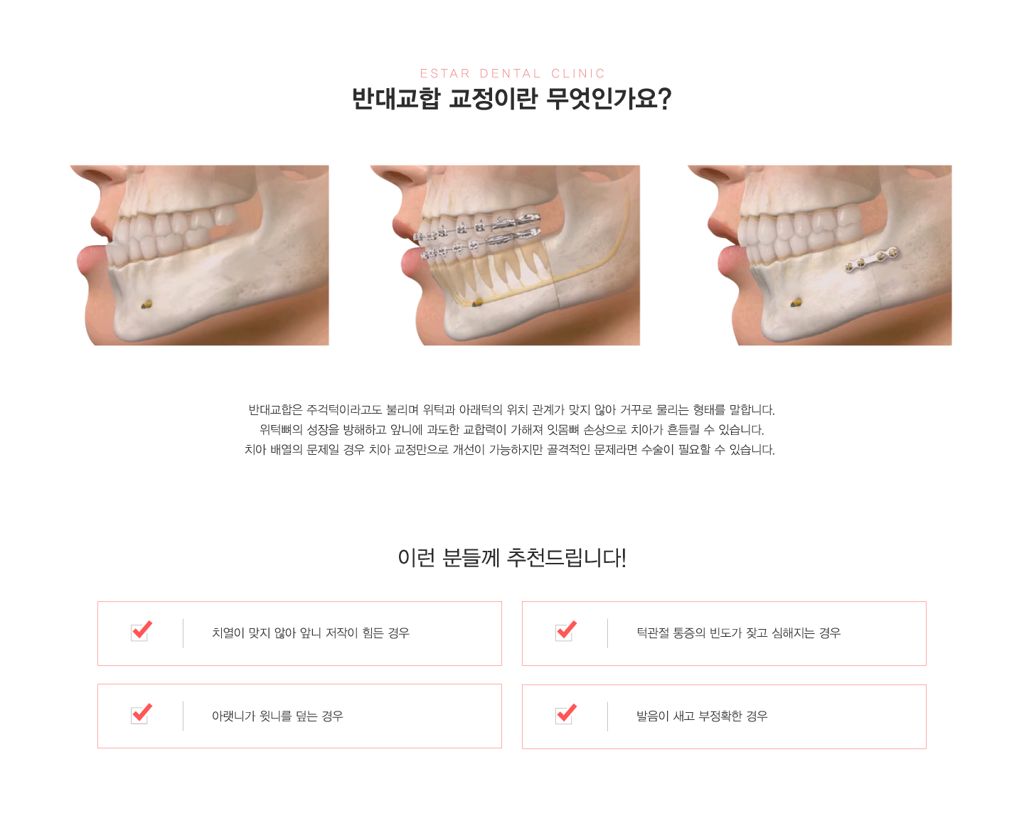 �ݴ뱳�ձ���