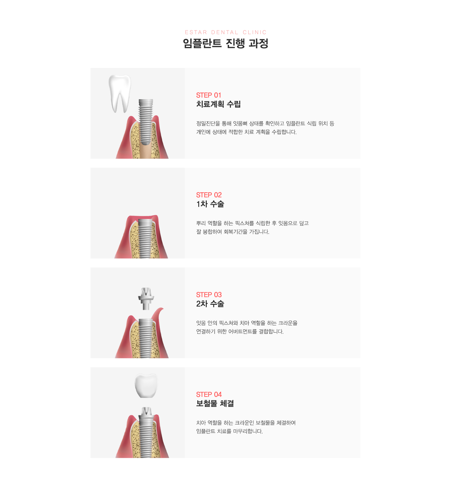 ���ö�Ʈ ���� ����