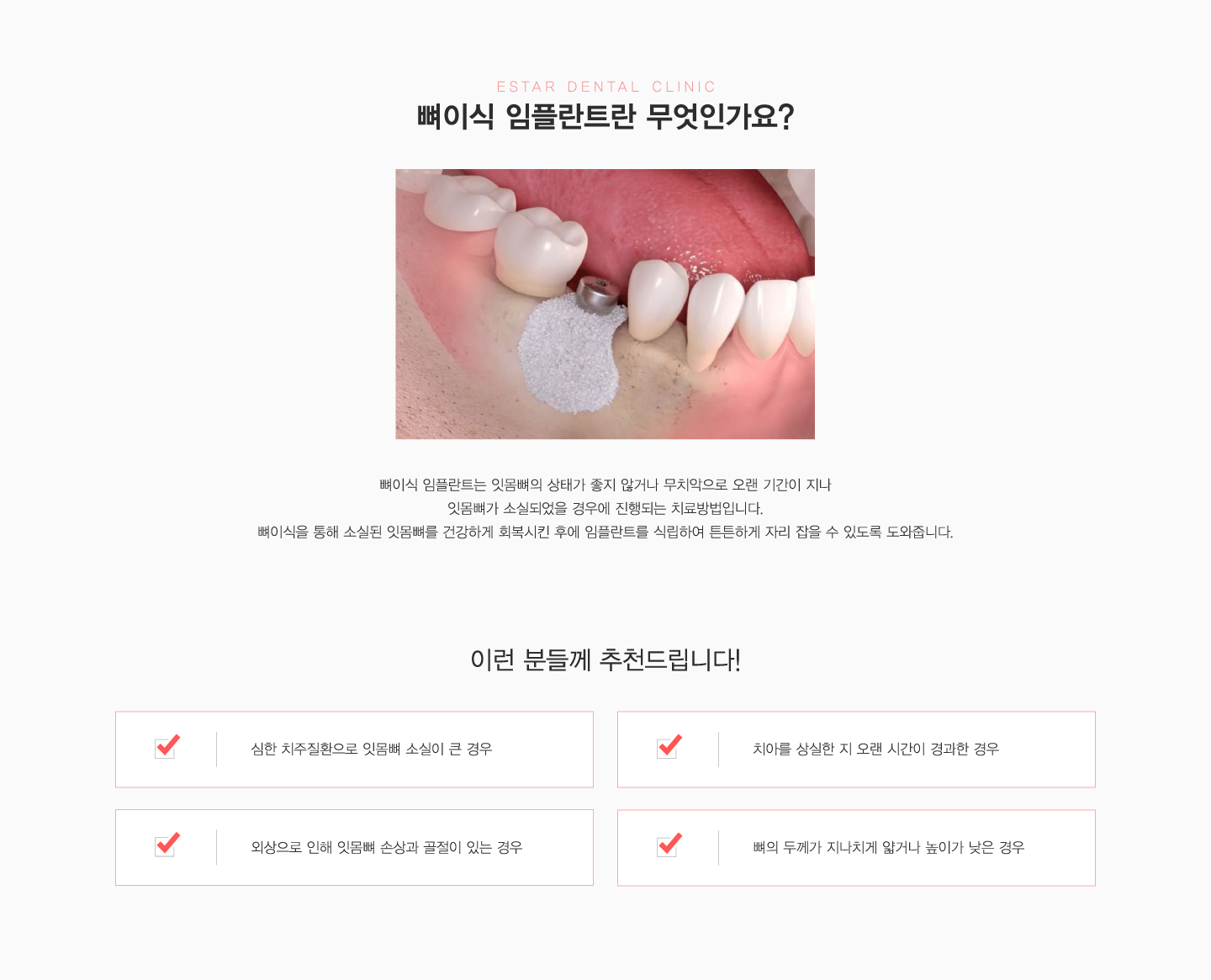 ���̽����ö�Ʈ�� �����ΰ��� ��õ���