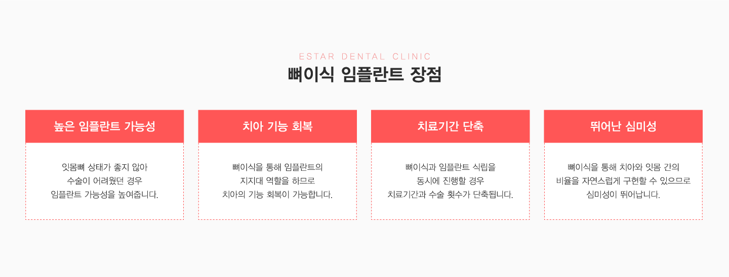 ���̽����ö�Ʈ ����