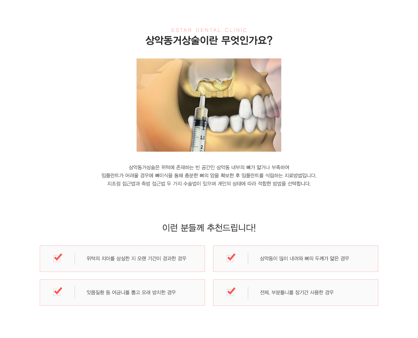 ��ǵ��Ż���̶� �����ΰ��� ��õ���