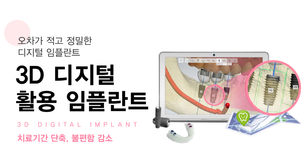 �׺���̼����ö�Ʈ