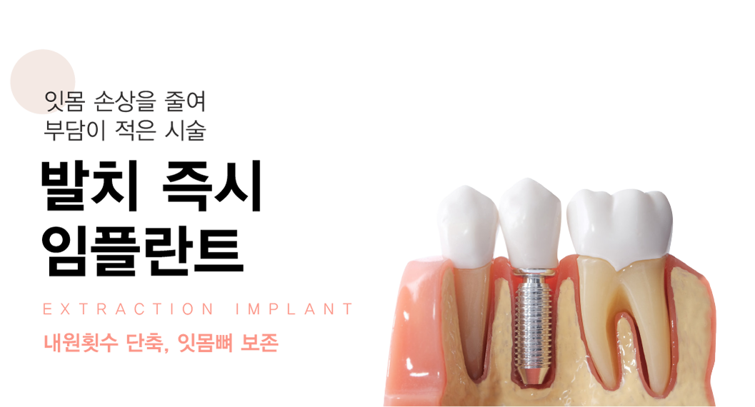 ��ġ������ö�Ʈ